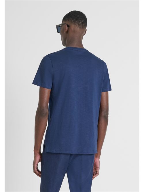  ANTONY MORATO | MMKS02528 FA100260/7132